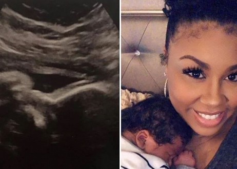La chanteuse gospel Blair Monique Walker atteinte d'un cancer de l'utérus est guérie et devient enceinte