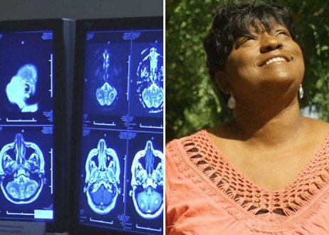 Une tumeur au cerveau disparaît après la prière chez une femme
