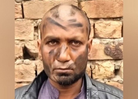 Pakistan : Un chrétien enlevé, battu et humilié en public par des voisins mus*lmans Pakistan : Un chrétien enlevé, battu et humilié en public par des voisins mus*lmans